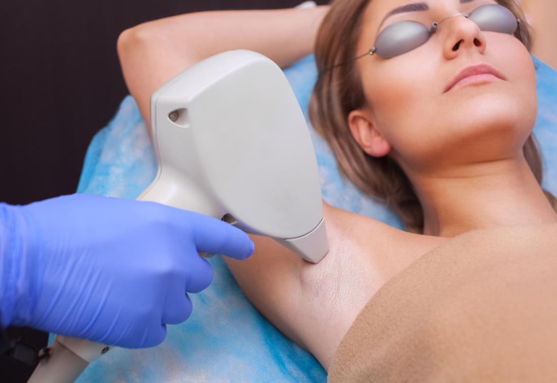 Important Things One Should Know About Laser Hair Removal