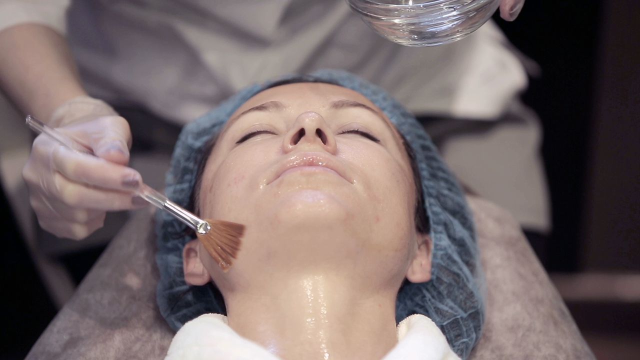 The Popularity of AHA Chemical Peels: An Overview