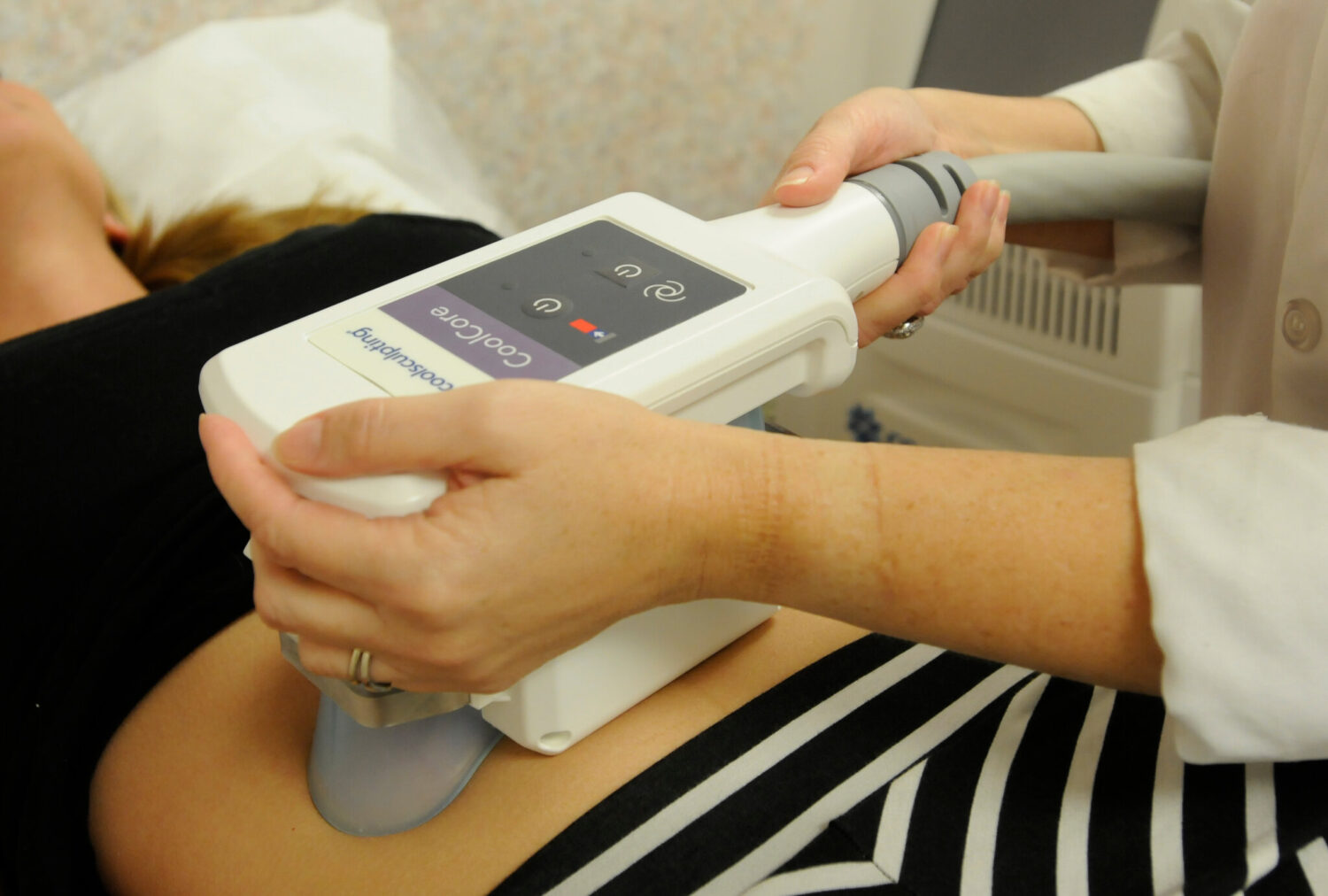 What Are The Benefits Of Coolsculpting?