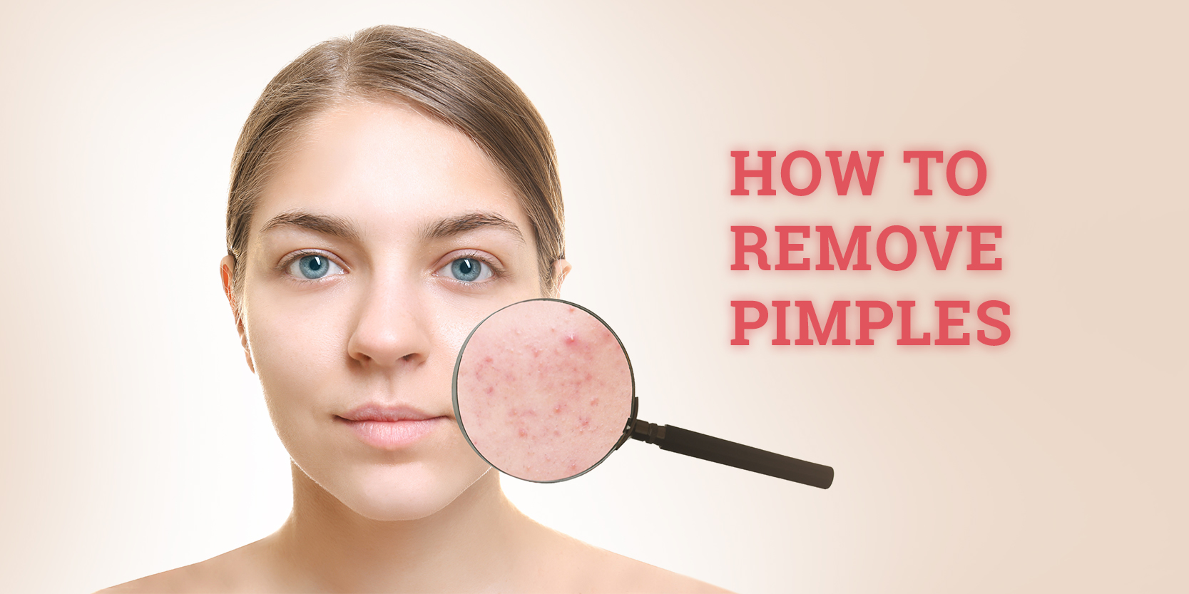 Tips and tricks to remove acne marks