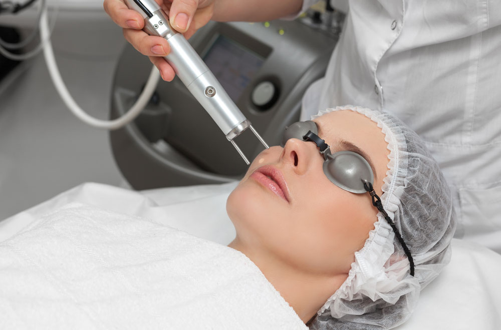 Managing Pico Laser Downtime: A Non-Surgical Recovery Guide