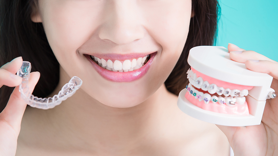Answering FAQs About Getting Braces In Gahanna Ohio