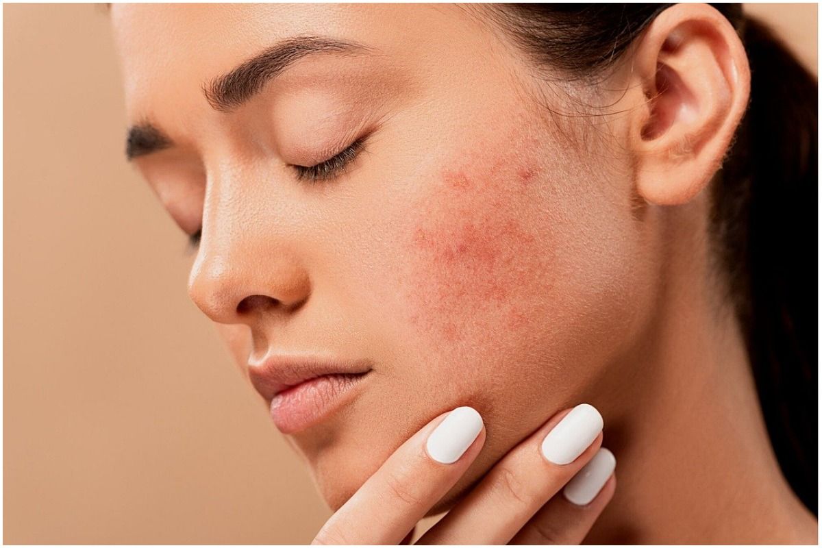 Common Skincare Mistakes That Can Damage Your Skin